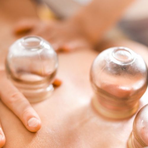 shutterstock_cuppingmassage-scaled-1040x500